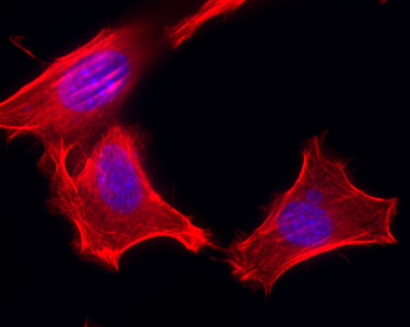 100x magnification of mouse embryonic fibroblasts stained with a dye for the actin protein cytoskeleton (RED) and nuclear DNA (BLUE)
